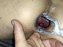 Anal thrill with daring medical tools