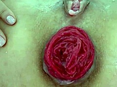 Destroyed Anal Prolapse in Extreme Close-Up Play