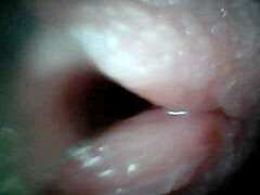 Wanna see male ejaculation caught on endoscope camera?
