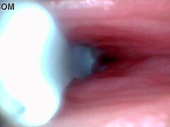 Wanna see male ejaculation caught on endoscope camera?